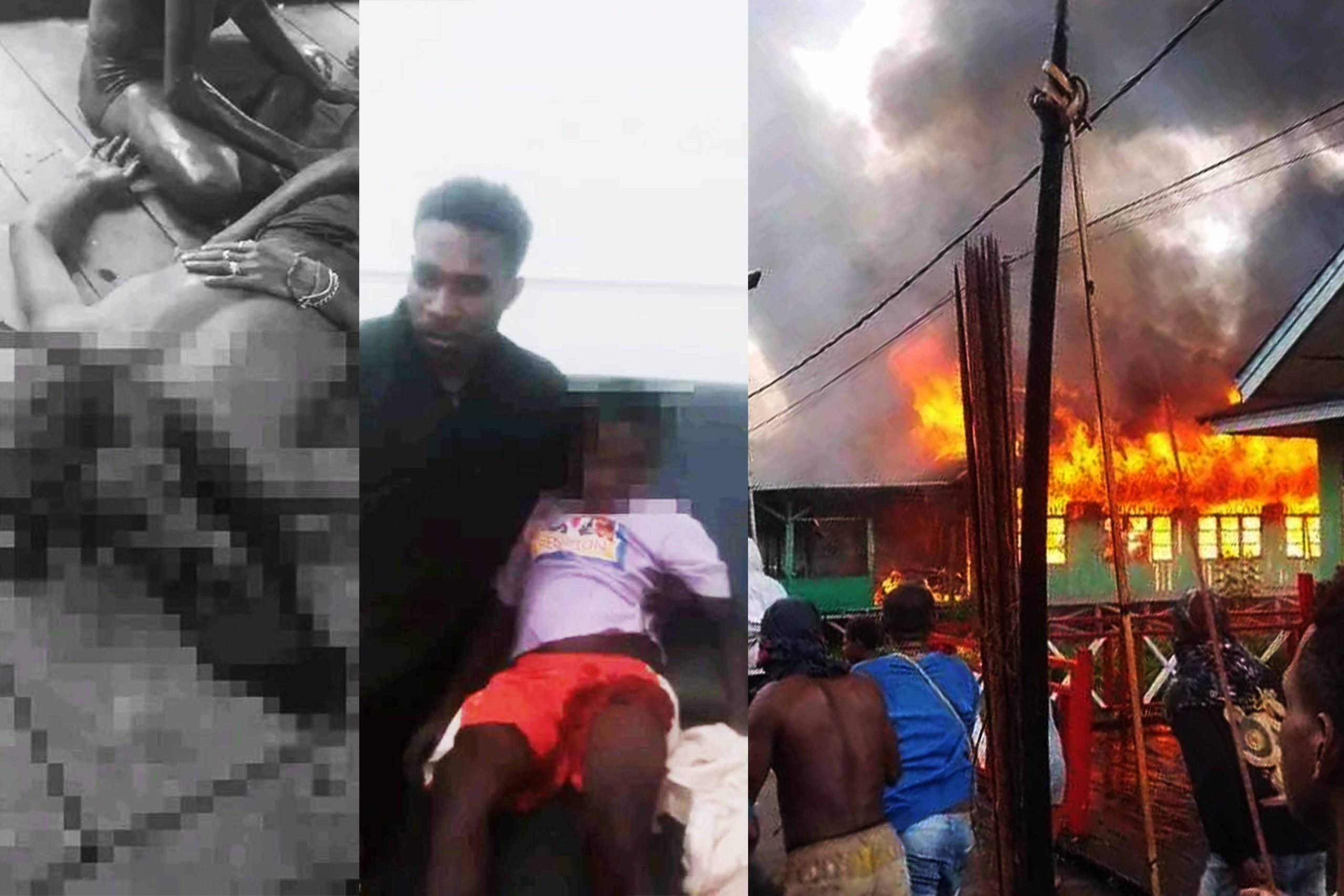Kolase Foto: Seorang Warga Tewas Ditembak, Anak Kecil Terluka Pada Bagian Paha Kanan Akibat Ditembak dan Pembakaran Pos Satgas TNI di Asmat.
